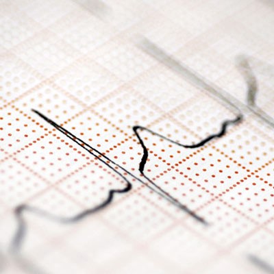 Ecografie și EKG